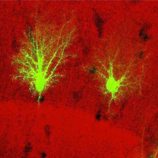  NCBI Organism:Rattus norvegicus; Cell Types:astrocyte, astrocyte of the hippocampus; Cell Components:cell projection cytoplasm, cell body; Biological process:forebrain astrocyte development