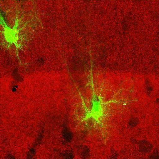  NCBI Organism:Rattus norvegicus; Cell Types:astrocyte, astrocyte of the hippocampus; Cell Components:cell projection cytoplasm, cell body; Biological process:forebrain astrocyte development