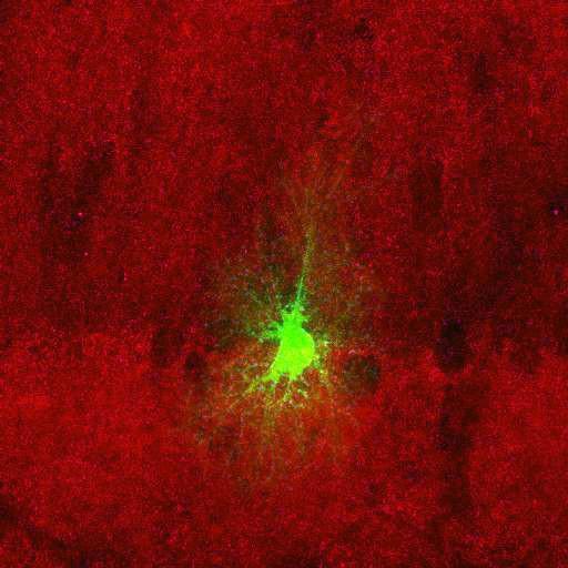  NCBI Organism:Rattus norvegicus; Cell Types:astrocyte, astrocyte of the hippocampus; Cell Components:cell projection cytoplasm, cell body; Biological process:forebrain astrocyte development