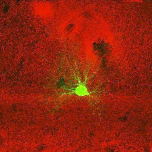  NCBI Organism:Rattus norvegicus; Cell Types:astrocyte, astrocyte of the hippocampus; Cell Components:cell projection cytoplasm, cell body; Biological process:forebrain astrocyte development