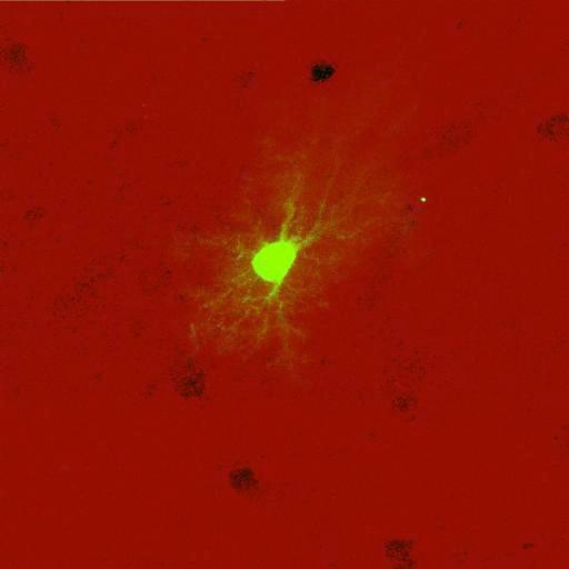  NCBI Organism:Rattus norvegicus; Cell Types:astrocyte, astrocyte of the hippocampus; Cell Components:cell projection cytoplasm, cell body; Biological process:forebrain astrocyte development