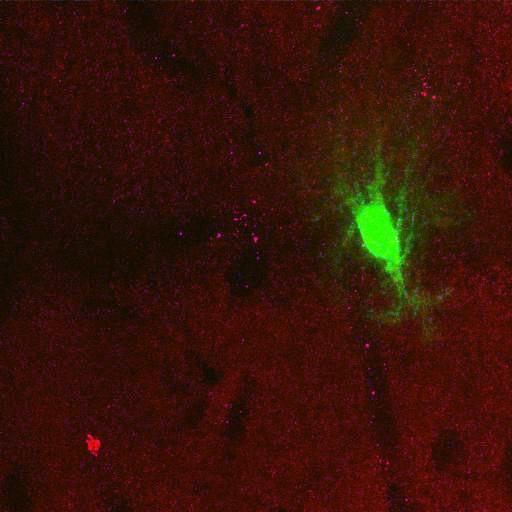  NCBI Organism:Rattus norvegicus; Cell Types:astrocyte, astrocyte of the hippocampus; Cell Components:cell projection cytoplasm, cell body; Biological process:forebrain astrocyte development