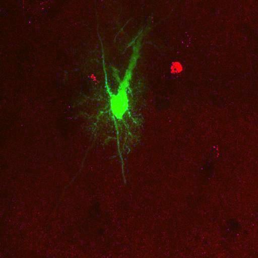  NCBI Organism:Rattus norvegicus; Cell Types:astrocyte, astrocyte of the hippocampus; Cell Components:cell projection cytoplasm, cell body; Biological process:forebrain astrocyte development