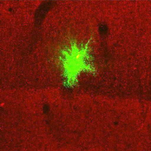  NCBI Organism:Rattus norvegicus; Cell Types:astrocyte, astrocyte of the hippocampus; Cell Components:cell projection cytoplasm, cell body; Biological process:forebrain astrocyte development