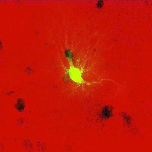  NCBI Organism:Rattus norvegicus; Cell Types:astrocyte, astrocyte of the hippocampus; Cell Components:cell projection cytoplasm, cell body; Biological process:forebrain astrocyte development