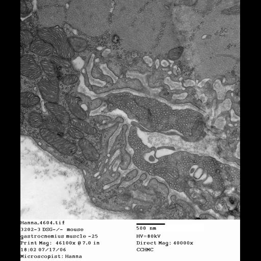  NCBI Organism:Mus musculus; Cell Types:skeletal muscle cell Cell Components:dystroglycan complex Biological process:plasma membrane organization