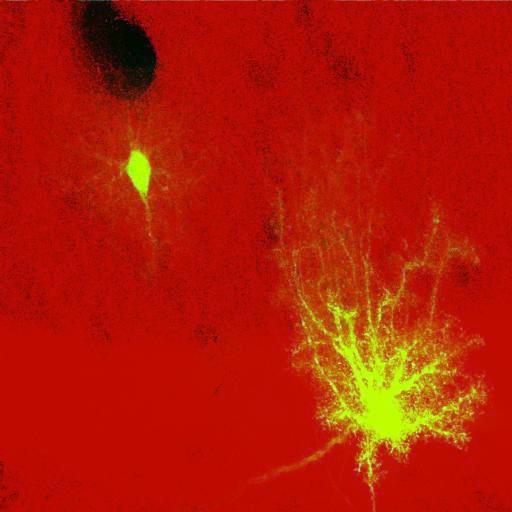  NCBI Organism:Rattus norvegicus; Cell Types:astrocyte, astrocyte of the hippocampus; Cell Components:cell projection cytoplasm, cell body; Biological process:forebrain astrocyte development