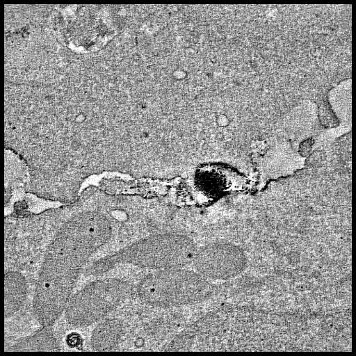  NCBI Organism:Homo sapiens, HTLV-1 subtype A, ; Cell Types:mature CD4 single-positive thymocyte, T cell; Biological process:initiation of viral infection