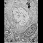 CIL_40191; NCBI Organism:Homo sapiens; Cell Types:pyramidal cell, neuron of cerebral cortex; Cell Components:neuronal cell body, Golgi apparatus, lipid particle, nucleus, nucleolus, plasma membrane;