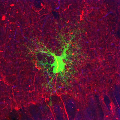  NCBI Organism:Rattus norvegicus; Cell Types:astrocyte of the hippocampus, astrocyte; Cell Components:cell projection cytoplasm, cell body; Biological process:forebrain astrocyte development, cell projection organization;