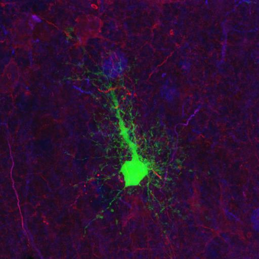  NCBI Organism:Rattus norvegicus; Cell Types:astrocyte of the hippocampus, astrocyte; Cell Components:cell projection cytoplasm, cell body; Biological process:forebrain astrocyte development, cell projection organization;