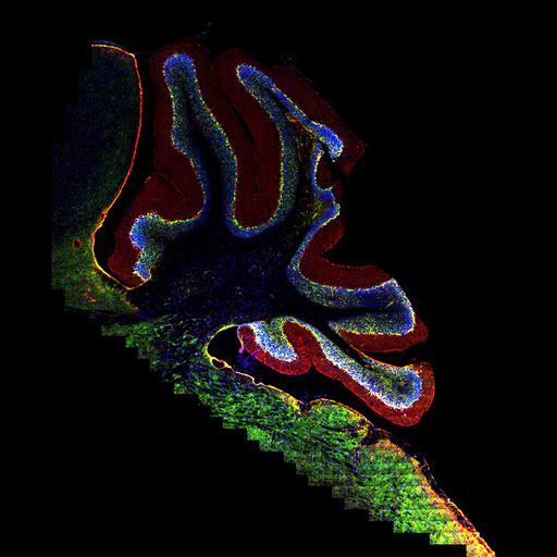  NCBI Organism:Mus musculus; Cell Types:CNS neuron (sensu Vertebrata), astrocyte of the cerebellum; Cell Components:intermediate filament, gap junction, nucleus;