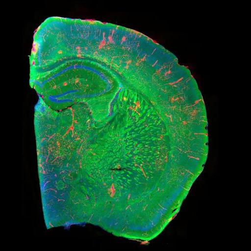  NCBI Organism:Mus musculus; Cell Types:CNS neuron (sensu Vertebrata), glial cell, blood vessel endothelial cell; Cell Components:myelin sheath, nucleus; Biological process:central nervous system structural organization