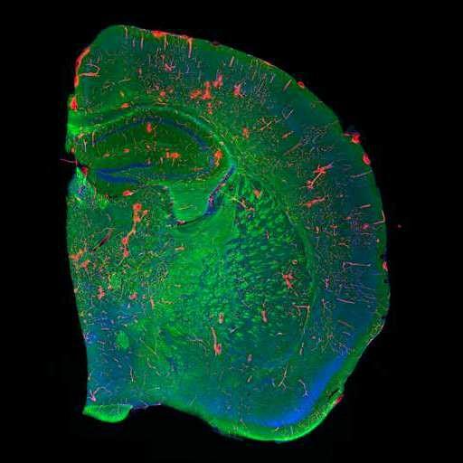  NCBI Organism:Mus musculus; Cell Types:CNS neuron (sensu Vertebrata), glial cell, blood vessel endothelial cell; Cell Components:myelin sheath, nucleus; Biological process:central nervous system structural organization