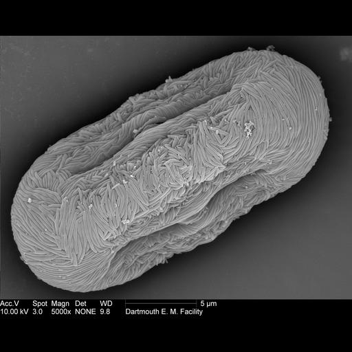  NCBI Organism:Anethum graveolens; Cell Components:pollen wall Biological process:pollen wall assembly