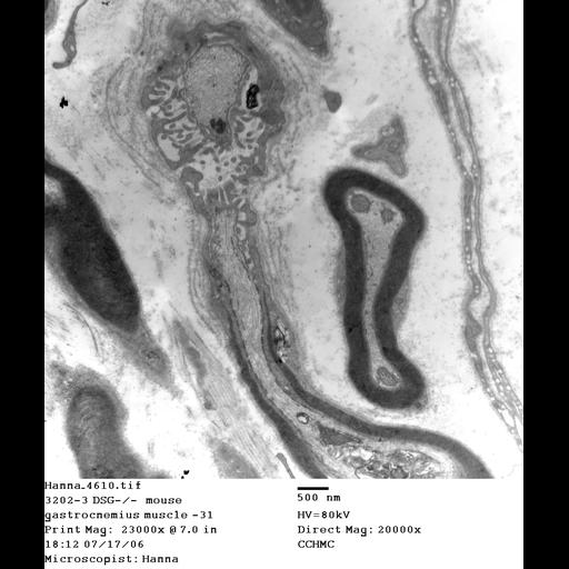  NCBI Organism:Mus musculus; Cell Types:skeletal muscle cell Cell Components:dystroglycan complex Biological process:plasma membrane organization