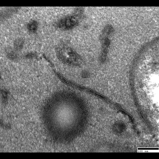  NCBI Organism:Saccharomyces cerevisiae; Cell Components:, lipid particle; Biological process:organelle organization, ;