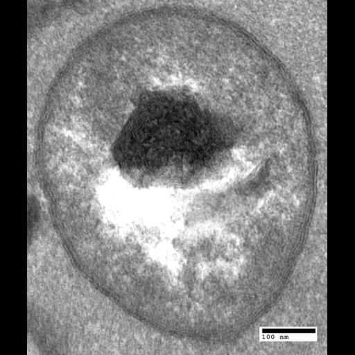  NCBI Organism:Saccharomyces cerevisiae; Cell Components:autophagic vacuole, autophagic vacuole membrane, autophagic vacuole lumen; Biological process:organelle organization, ;