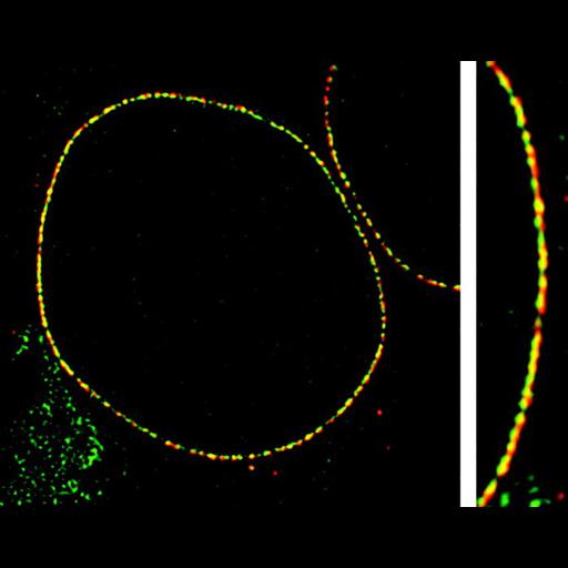  NCBI Organism:Homo sapiens; Cell Types:epithelial cell, ; Cell Components:nucleus, nuclear envelope, nuclear pore; Biological process:nucleus organization, nuclear transport, nuclear envelope organization;