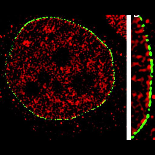  NCBI Organism:Homo sapiens; Cell Types:epithelial cell, ; Cell Components:nucleus, nuclear envelope, nuclear pore; Biological process:nucleus organization, nuclear transport, nuclear envelope organization;