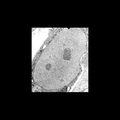  NCBI Organism:Homo sapiens; Cell Types:epithelial cell, ; Cell Components:nucleus, nuclear envelope, nucleolus, nuclear chromatin; Biological process:nucleus organization, nuclear transport;