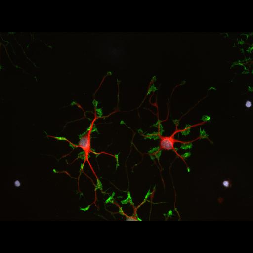  NCBI Organism:Rattus norvegicus; Cell Types:oligodendrocyte Cell Components:actin cytoskeleton, microtubule, nucleus, ; Biological process:oligodendrocyte development