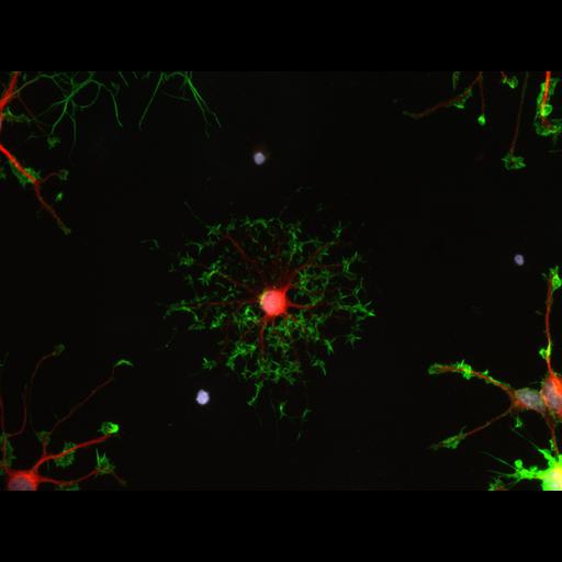  NCBI Organism:Rattus norvegicus; Cell Types:oligodendrocyte Cell Components:actin cytoskeleton, microtubule, nucleus, ; Biological process:oligodendrocyte development