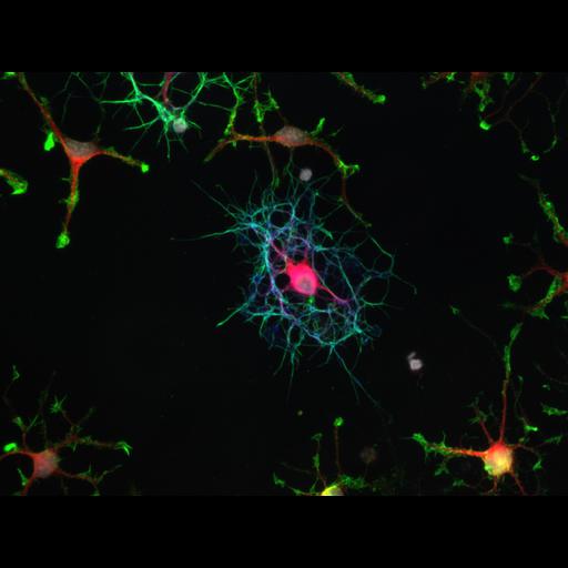  NCBI Organism:Rattus norvegicus; Cell Types:oligodendrocyte Cell Components:actin cytoskeleton, microtubule, nucleus, ; Biological process:oligodendrocyte development