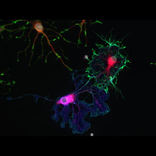  NCBI Organism:Rattus norvegicus; Cell Types:oligodendrocyte Cell Components:actin cytoskeleton, microtubule, nucleus, ; Biological process:oligodendrocyte development