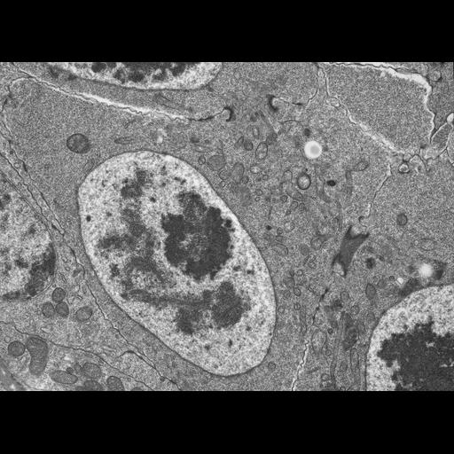  NCBI Organism:Drosophila melanogaster; Cell Components:synaptonemal complex, nucleus; Biological process:synaptonemal complex organization