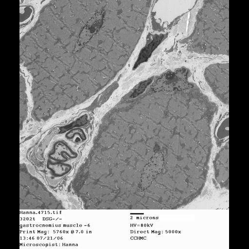  NCBI Organism:Mus musculus; Cell Types:skeletal muscle cell Cell Components:dystroglycan complex Biological process:plasma membrane organization