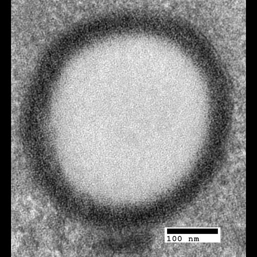  NCBI Organism:Saccharomyces cerevisiae; Cell Components:lipid particle, cytoplasmic vesicle membrane; Biological process:organelle organization, ;