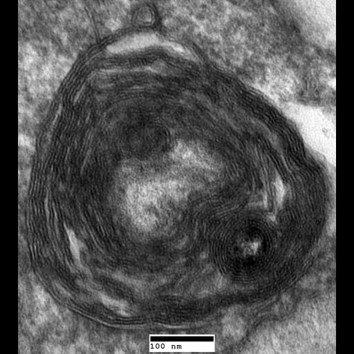  NCBI Organism:Saccharomyces cerevisiae; Biological process:organelle organization, ;