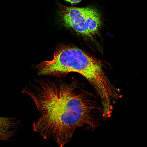  NCBI Organism:Homo sapiens; Cell Components:endoplasmic reticulum, nucleus, microtubule cytoskeleton; Biological process:organelle organization, cytoskeleton organization;