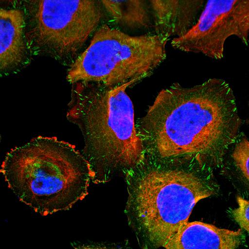  NCBI Organism:Homo sapiens; Cell Components:focal adhesion, microtubule cytoskeleton, nucleus; Biological process:organelle organization, cytoskeleton organization;