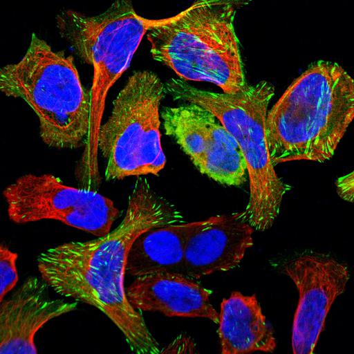  NCBI Organism:Homo sapiens; Cell Components:actin cytoskeleton, focal adhesion, microtubule cytoskeleton, nucleus; Biological process:organelle organization, cytoskeleton organization;