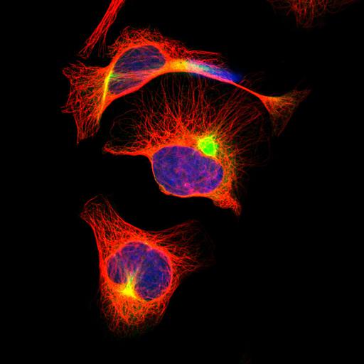  NCBI Organism:Homo sapiens; Cell Components:endoplasmic reticulum, intermediate filament, aggresome, nucleus, microtubule cytoskeleton; Biological process:organelle organization, cytoskeleton organization;