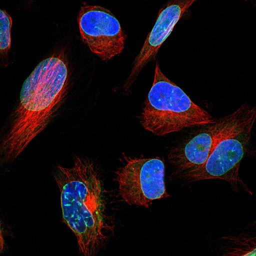  NCBI Organism:Homo sapiens; Cell Components:nuclear membrane, nucleus, microtubule cytoskeleton; Biological process:organelle organization, cytoskeleton organization;