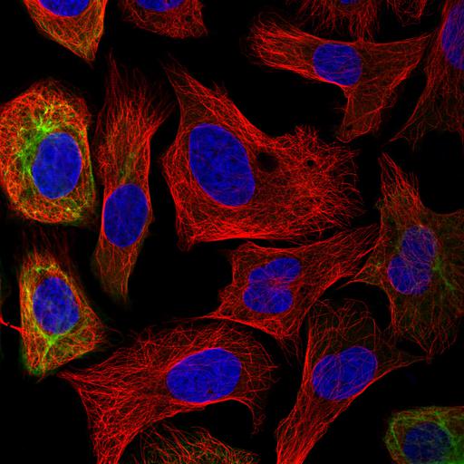  NCBI Organism:Homo sapiens; Cell Components:intermediate filament, nucleus, microtubule cytoskeleton; Biological process:organelle organization, cytoskeleton organization;