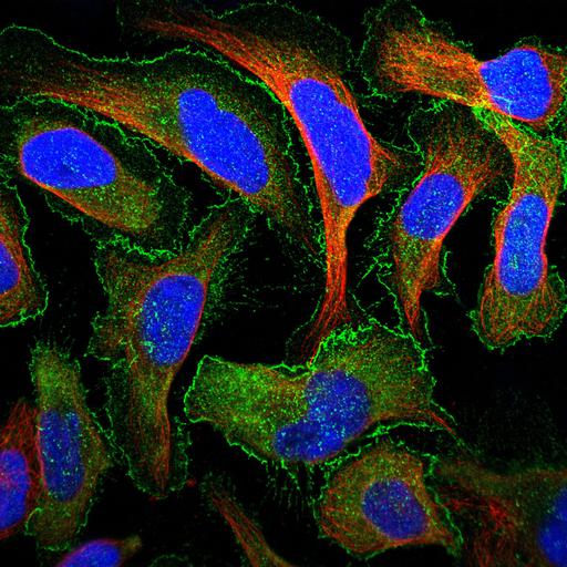  NCBI Organism:Homo sapiens; Cell Components:plasma membrane, cytoplasm, nucleus, microtubule cytoskeleton; Biological process:organelle organization, cytoskeleton organization;