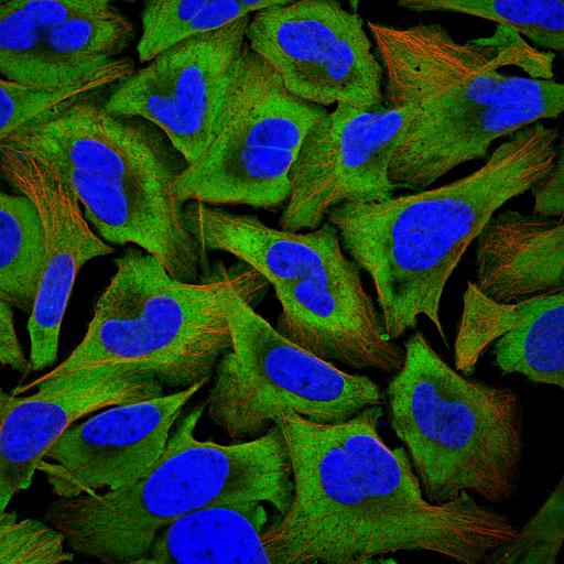 NCBI Organism:Homo sapiens; Cell Components:cytoplasm, nucleus, microtubule cytoskeleton; Biological process:organelle organization, cytoskeleton organization;