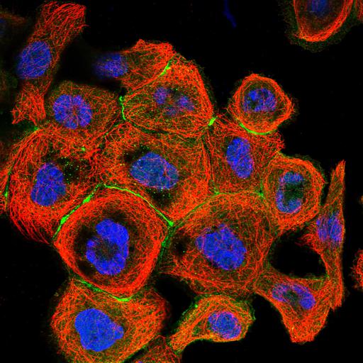  NCBI Organism:Homo sapiens; Cell Components:cell junction, nucleus, microtubule cytoskeleton; Biological process:organelle organization, cytoskeleton organization;