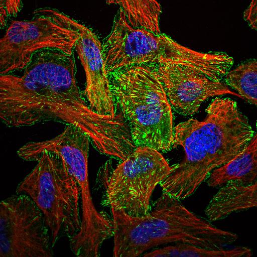  NCBI Organism:Homo sapiens; Cell Components:focal adhesion, cytoplasm, plasma membrane, nucleus, microtubule cytoskeleton; Biological process:organelle organization, cytoskeleton organization;