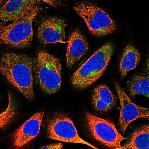  NCBI Organism:Homo sapiens; Cell Components:cytoplasm, intermediate filament cytoskeleton, aggresome, nucleus, microtubule cytoskeleton; Biological process:organelle organization, cytoskeleton organization;