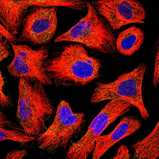  NCBI Organism:Homo sapiens; Cell Components:vesicle, nucleus, microtubule cytoskeleton; Biological process:organelle organization, cytoskeleton organization;