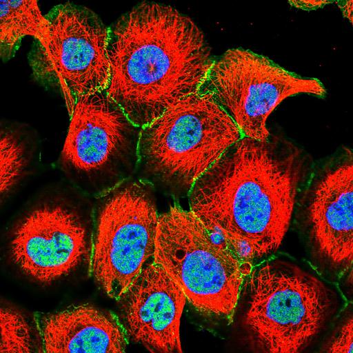  NCBI Organism:Homo sapiens; Cell Components:plasma membrane, cell junction, nucleus, microtubule cytoskeleton; Biological process:organelle organization, cytoskeleton organization;