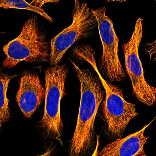  NCBI Organism:Homo sapiens; Cell Components:microtubule cytoskeleton, nucleus; Biological process:organelle organization, cytoskeleton organization;