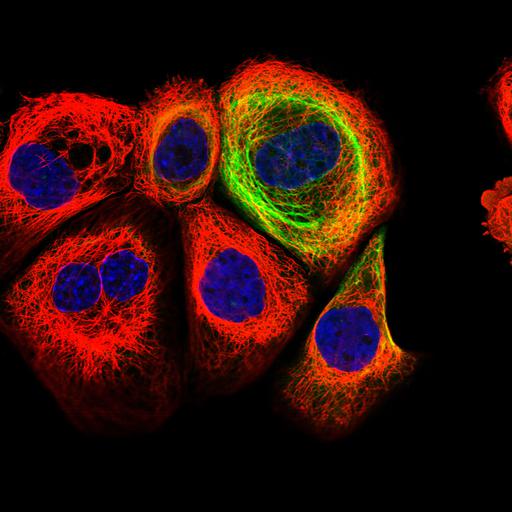  NCBI Organism:Homo sapiens; Cell Components:cytoplasm, intermediate filament cytoskeleton, nucleus, microtubule cytoskeleton; Biological process:organelle organization, cytoskeleton organization;