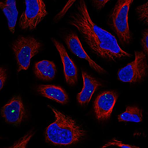  NCBI Organism:Homo sapiens; Cell Components:nucleus, microtubule cytoskeleton; Biological process:organelle organization, cytoskeleton organization;