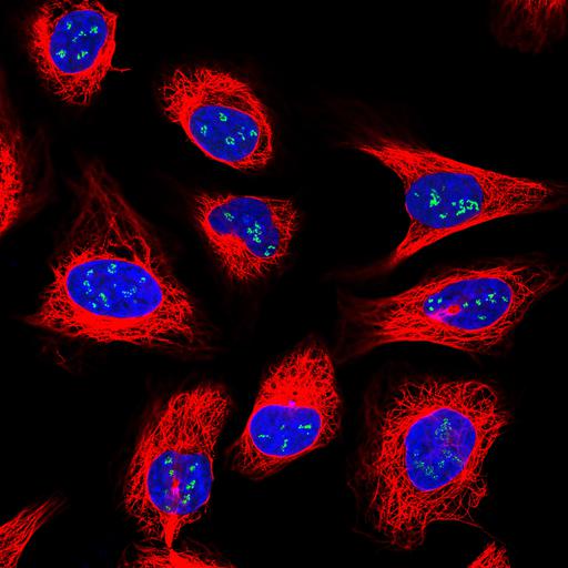  NCBI Organism:Homo sapiens; Cell Components:nucleolus, nucleus, microtubule cytoskeleton; Biological process:organelle organization, cytoskeleton organization;